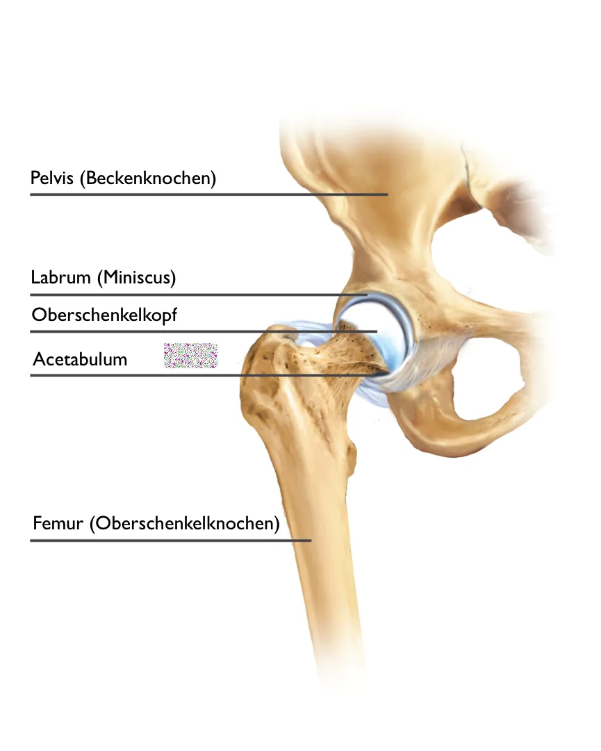 Beschriftete Darstellung des Hüftgelenks mit Becken, Labrum, Oberschenkelkopf, Acetabulum und Femur