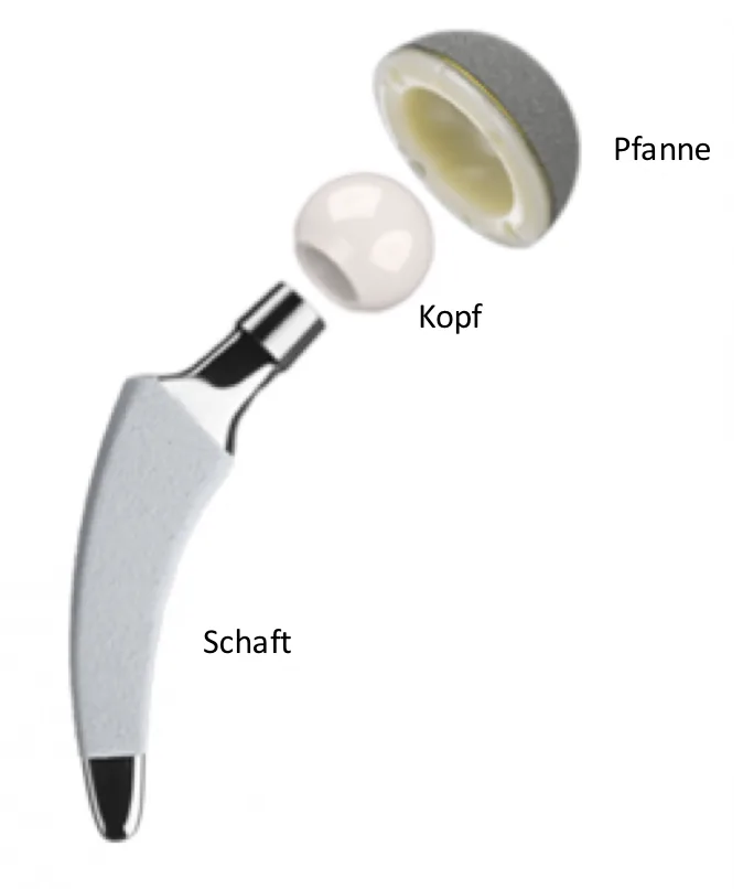 Bestandteile einer Hüfttotalprothese: Pfanne, Kopf und Schaft